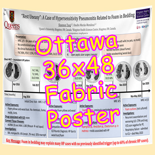 Cheapest Advance Order Fabric Research Poster Printing in Ottawa 36x48 from $70