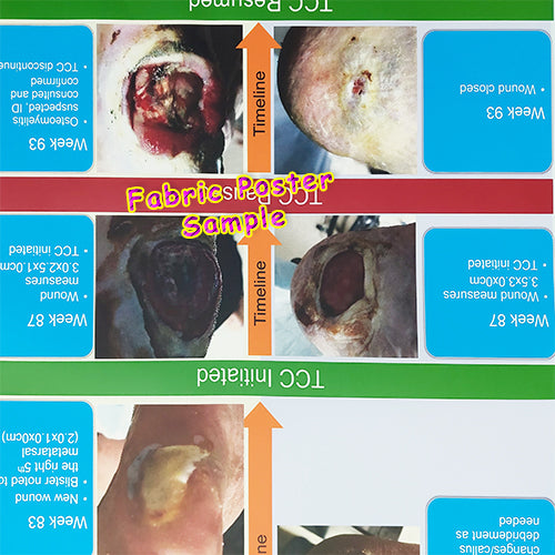 Fabric Poster Prints High Quality Medical Photos