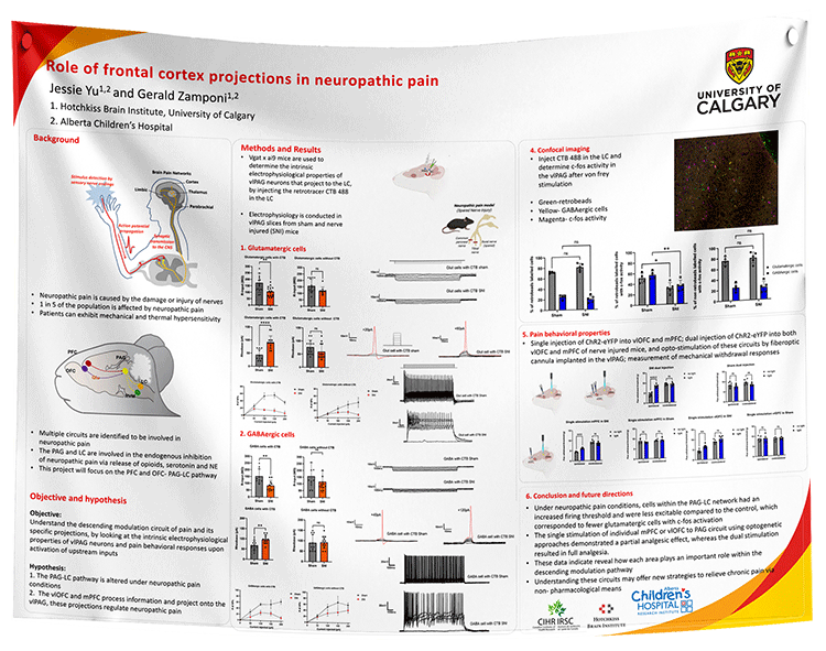 Alberta / Calgary University / AHS Alberta Health Service Fabric Research Poster A0 (33x47 in)